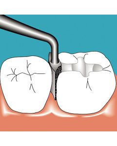 Sonicflex Approx nr. 36 stor, mesial